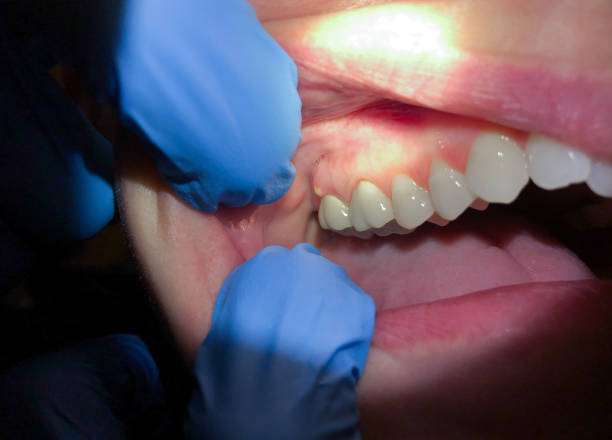 Best Emergency Cosmetic Dentistry in White Haven, PA